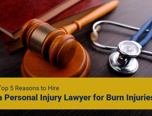 Top 5 Reasons to Hire a Personal Injury Lawyer for Burn Injuries