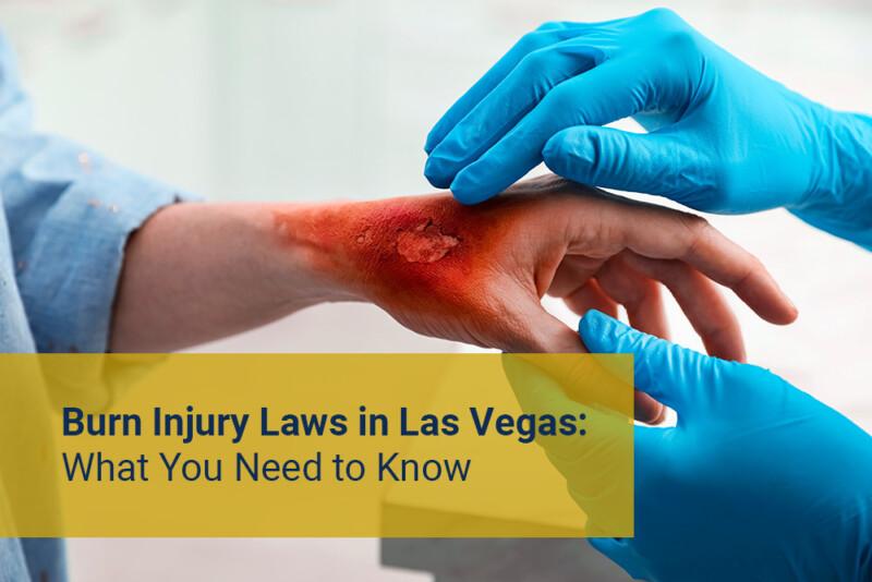 Burn Injury Laws in Las Vegas What You Need to