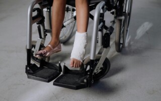 Close-up of wheelchair pedals with a person’s casted leg and bare foot resting on them.
