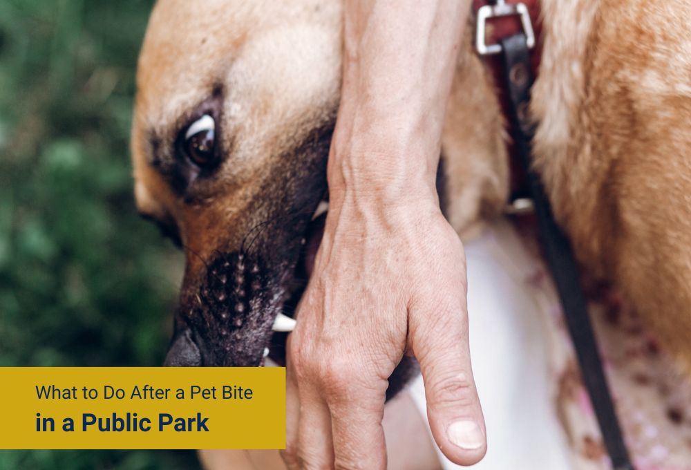 What to Do After a Pet Bite in a Public Park
